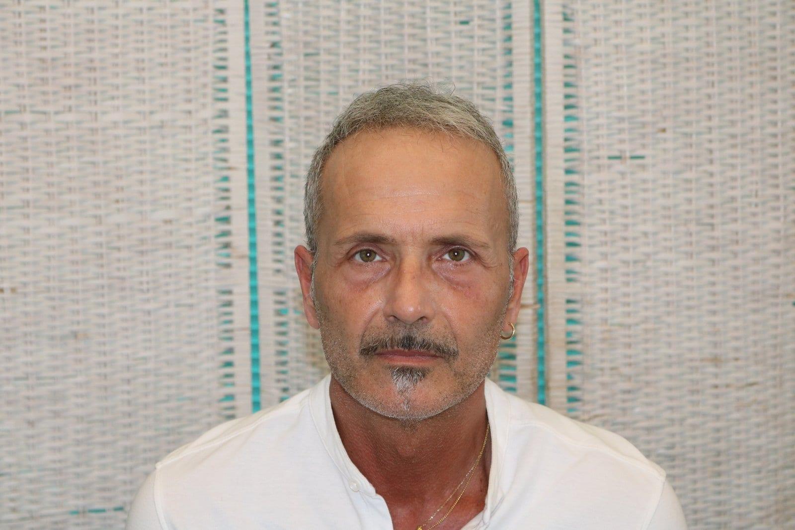 Dopo: tricopigmentazione effetto infoltimento a Firenze — Caso Prima / Dopo #21 (foto 6)