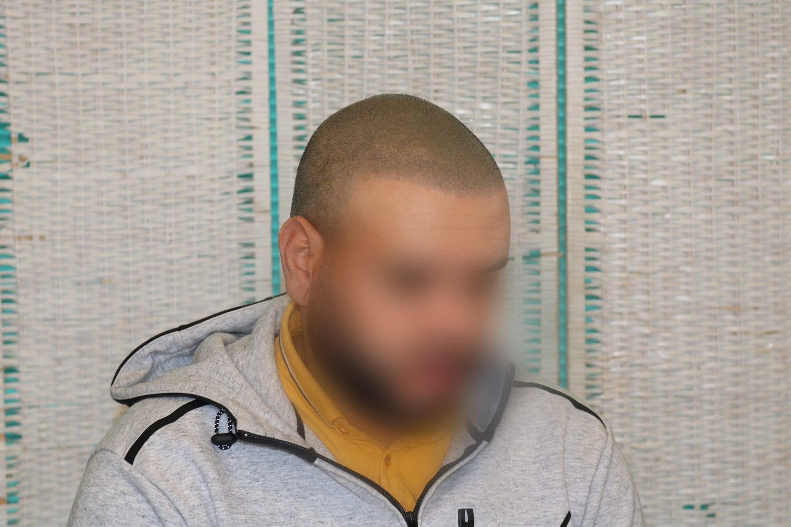 Dopo: tricopigmentazione effetto rasato a Firenze — Caso Prima / Dopo #26 (foto 3)