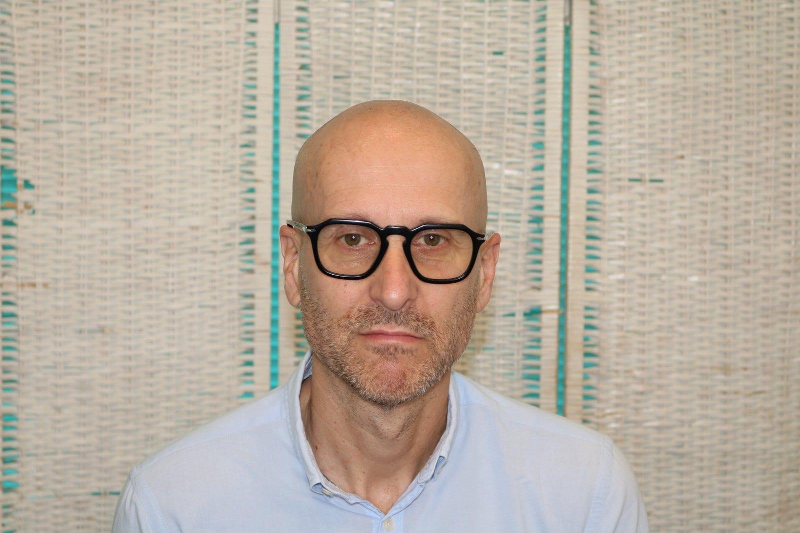 Prima: tricopigmentazione effetto rasato a Firenze — Caso Prima / Dopo #28 (foto 6)