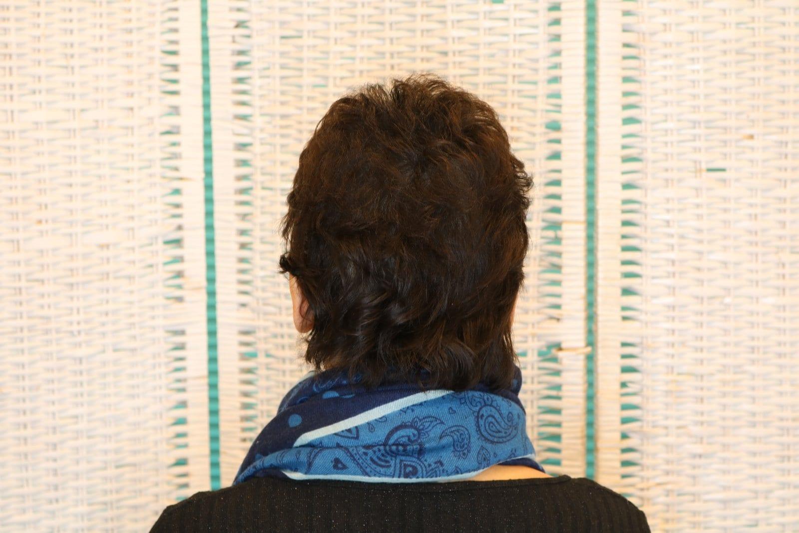 Dopo: tricopigmentazione sezione donna a Firenze — Caso Prima / Dopo #10 (foto 7)