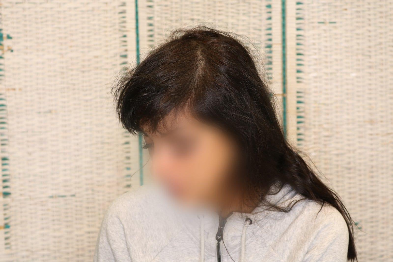 Dopo: tricopigmentazione sezione donna a Firenze — Caso Prima / Dopo #11 (foto 2)