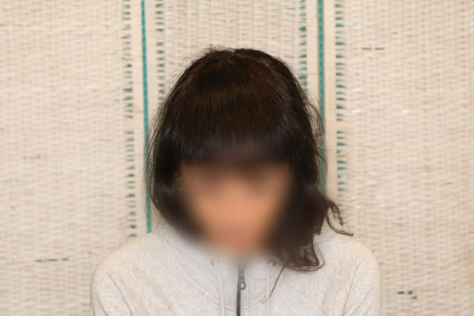 Dopo: tricopigmentazione sezione donna a Firenze — Caso Prima / Dopo #11 (foto 6)