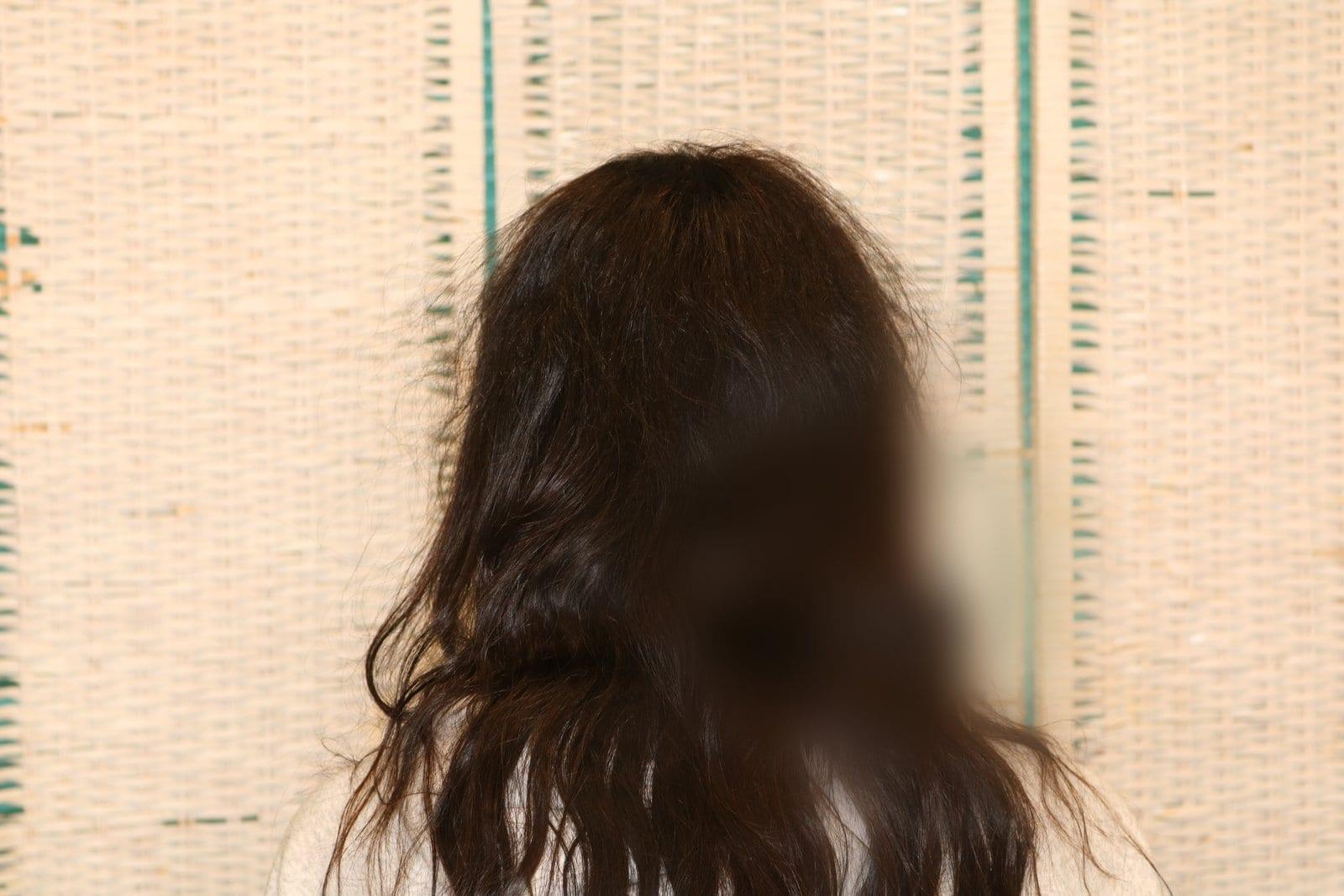 Dopo: tricopigmentazione sezione donna a Firenze — Caso Prima / Dopo #11 (foto 7)
