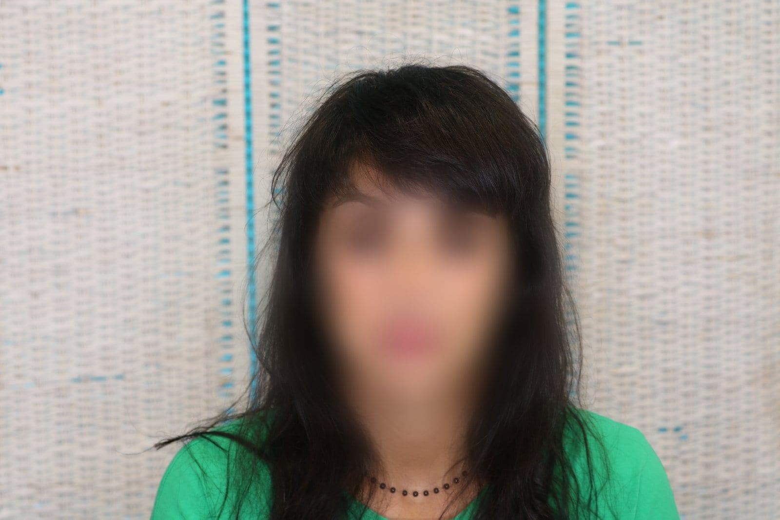 Prima: tricopigmentazione sezione donna a Firenze — Caso Prima / Dopo #11 (foto 1)