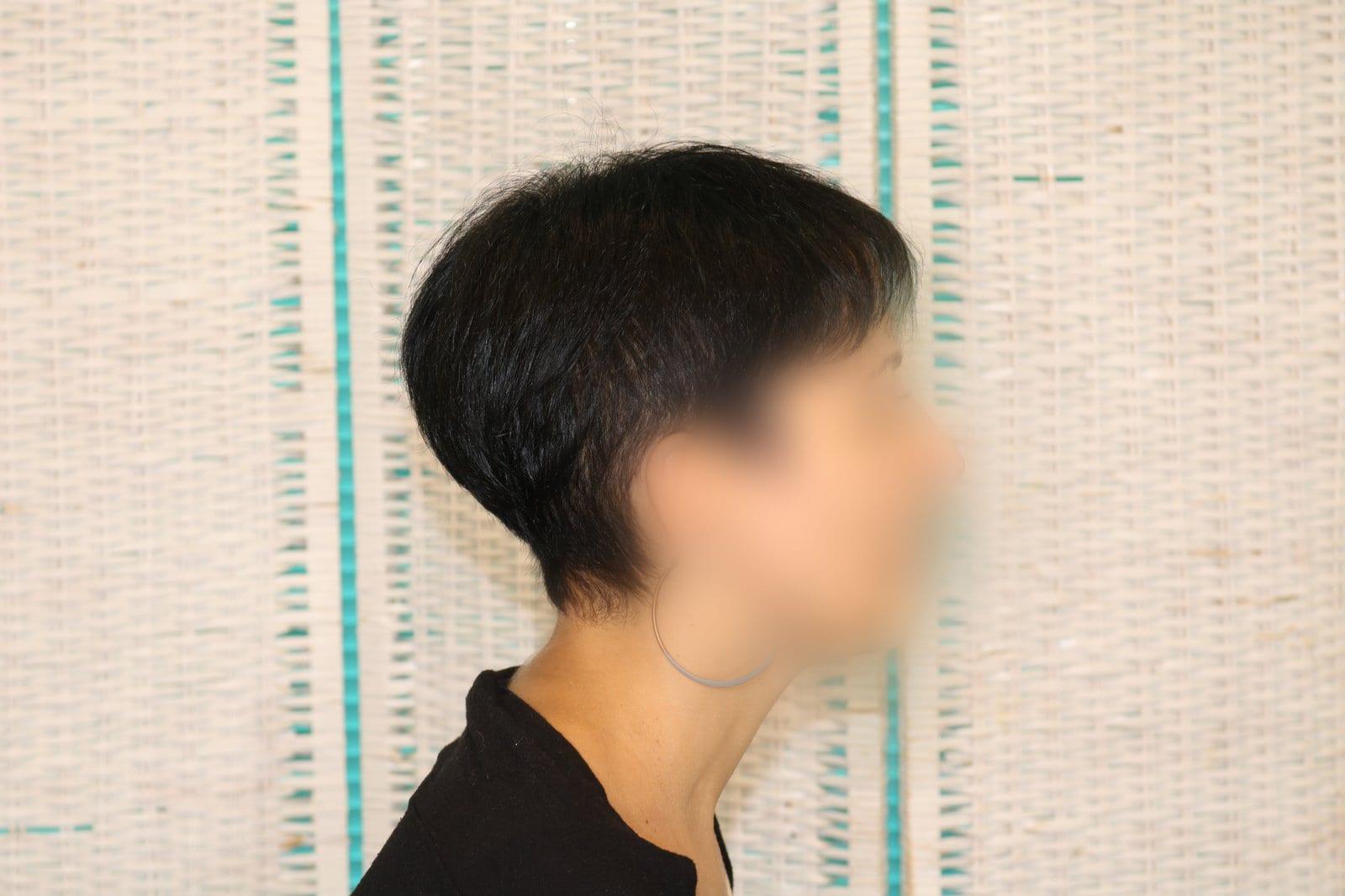 Dopo: tricopigmentazione sezione donna a Firenze — Caso Prima / Dopo #12 (foto 7)