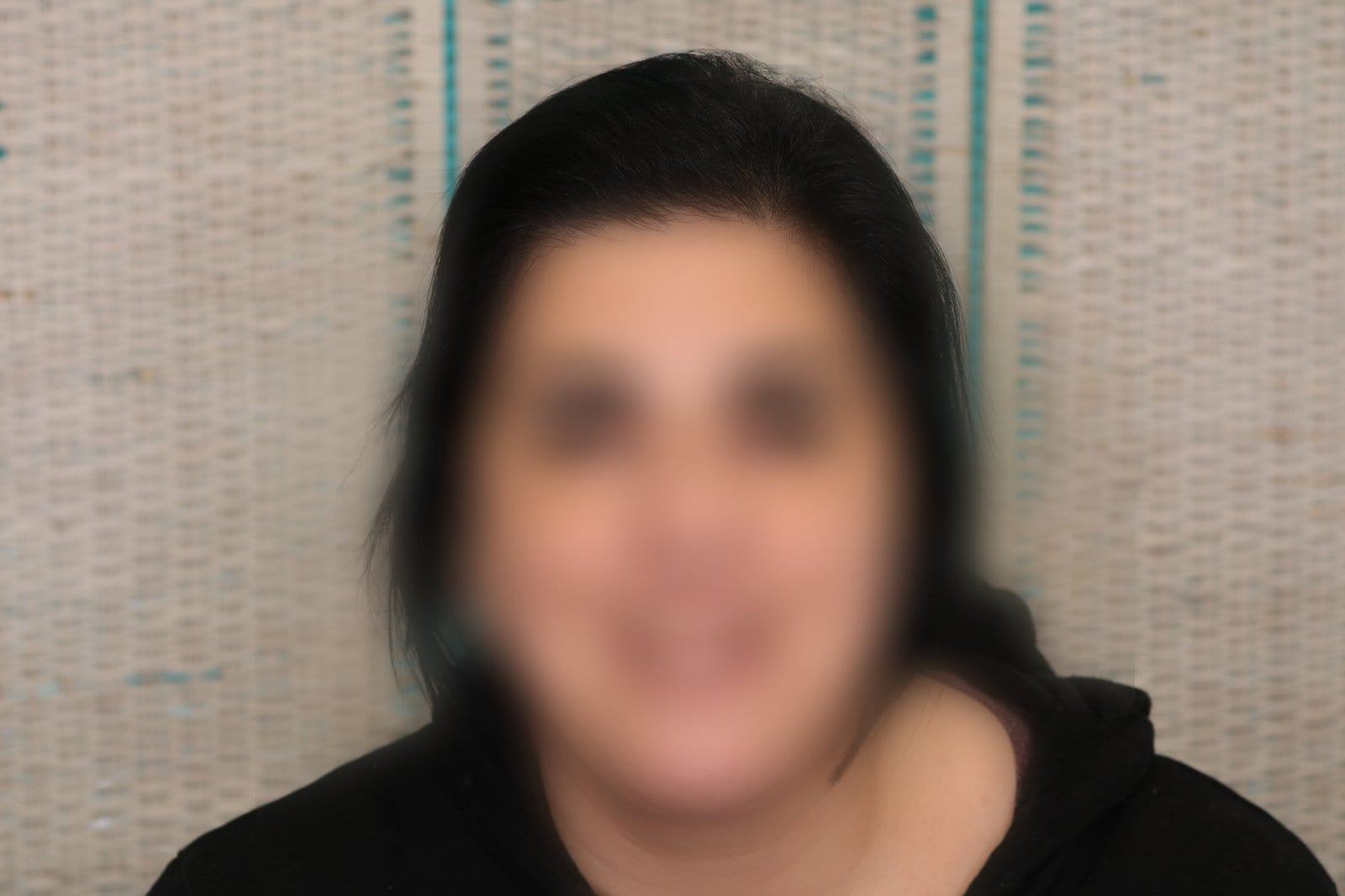Dopo: tricopigmentazione sezione donna a Firenze — Caso Prima / Dopo #14 (foto 6)