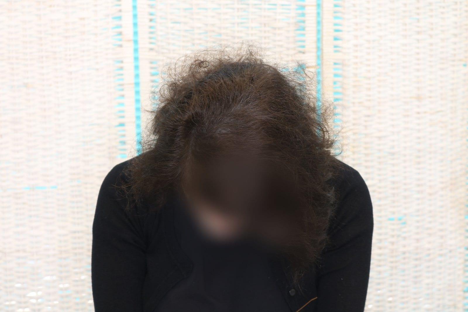 Dopo: tricopigmentazione sezione donna a Firenze — Caso Prima / Dopo #15 (foto 3)