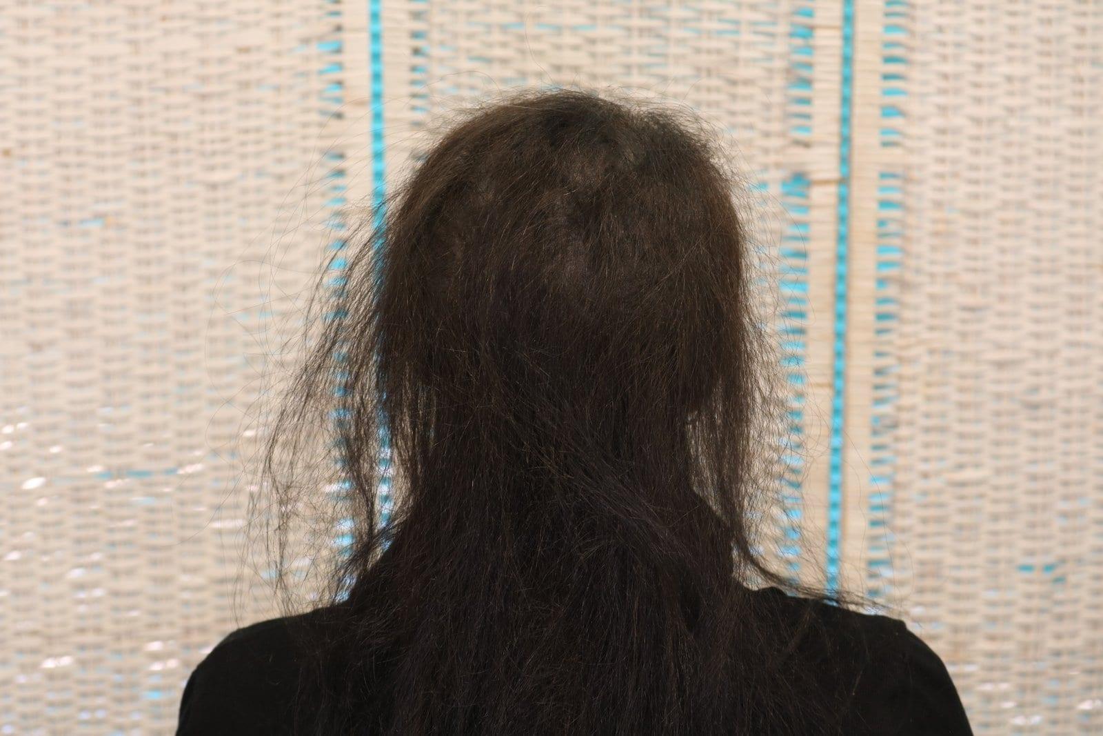 Dopo: tricopigmentazione sezione donna a Firenze — Caso Prima / Dopo #19 (foto 4)