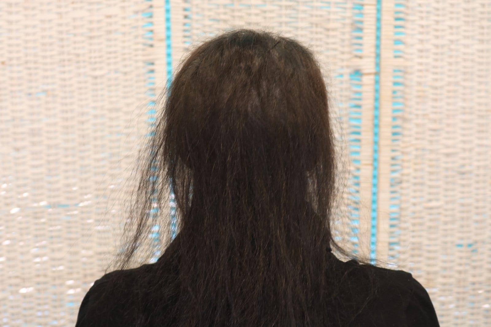 Dopo: tricopigmentazione sezione donna a Firenze — Caso Prima / Dopo #19 (foto 9)