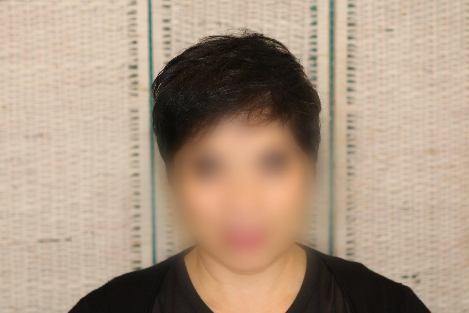 Dopo: tricopigmentazione sezione donna a Firenze — Caso Prima / Dopo #7 (foto 2)
