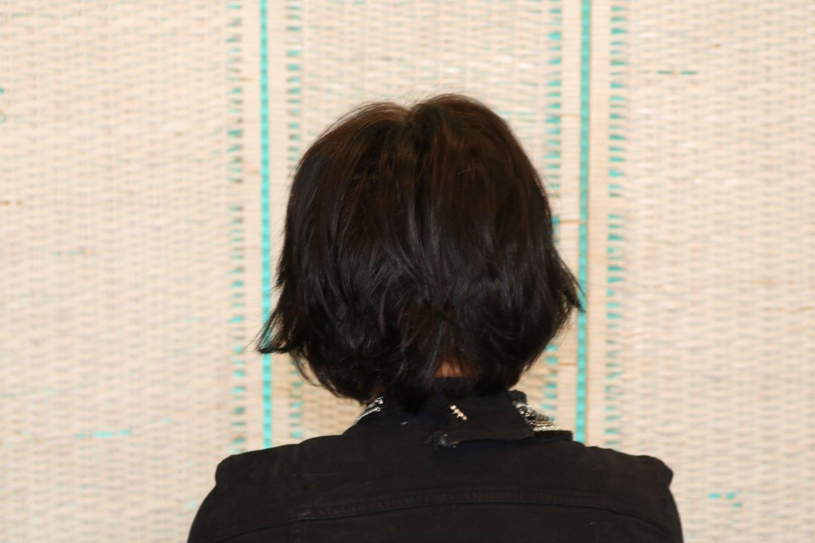 Prima: tricopigmentazione sezione donna a Firenze — Caso Prima / Dopo #8 (foto 2)