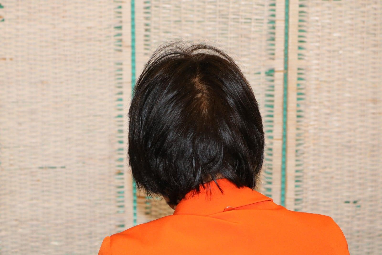 Prima: tricopigmentazione sezione donna a Firenze — Caso Prima / Dopo #8 (foto 8)