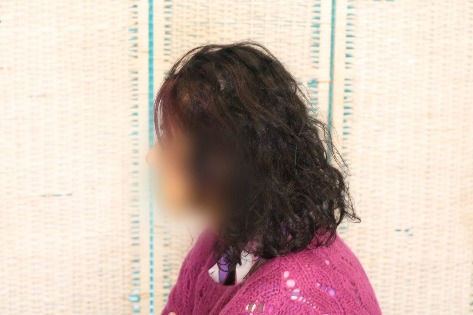 Dopo: tricopigmentazione sezione donna a Firenze — Caso Prima / Dopo #9 (foto 1)