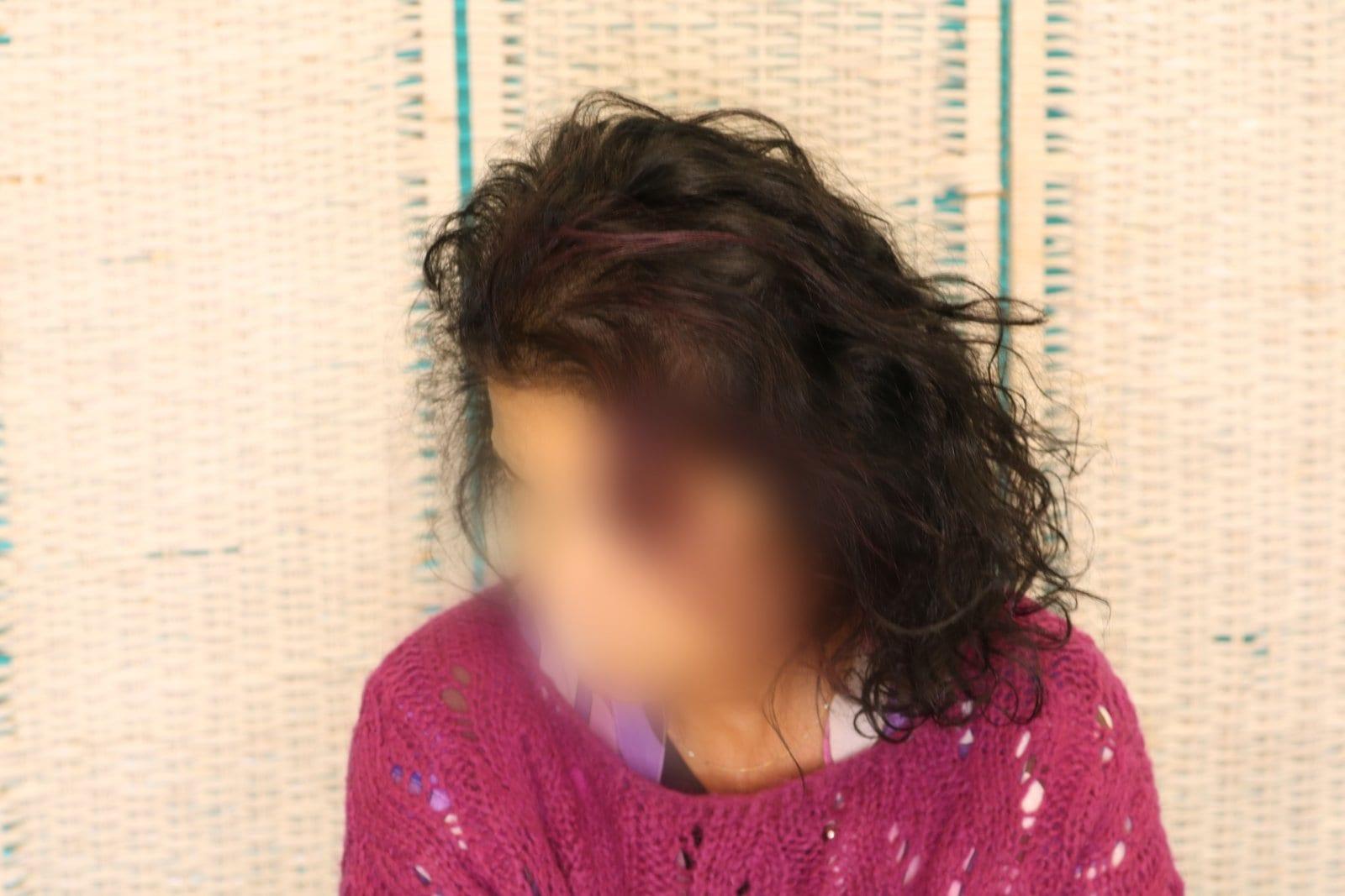 Dopo: tricopigmentazione sezione donna a Firenze — Caso Prima / Dopo #9 (foto 3)