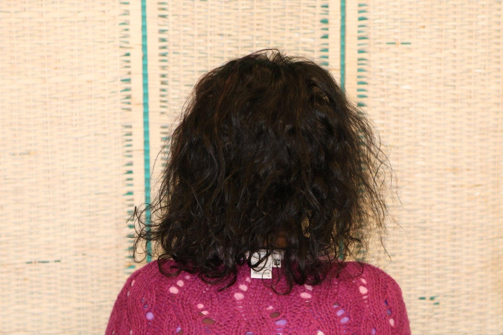 Dopo: tricopigmentazione sezione donna a Firenze — Caso Prima / Dopo #9 (foto 4)