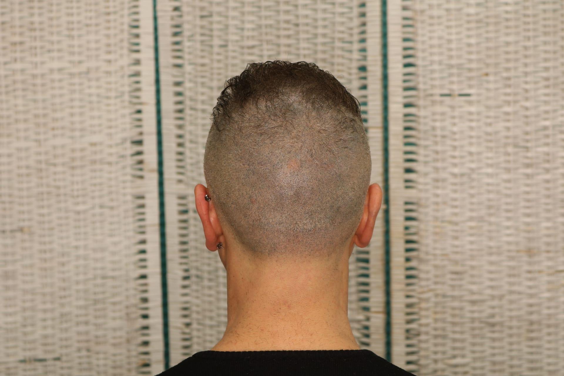 img-2